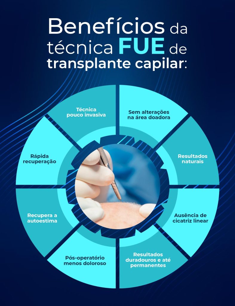 Benefícios da técnica FUE de transplante capilar:

Pós-operatório menos doloroso;
Ausência de cicatriz linear;
Rápida recuperação;
Resultados naturais;
Recupera a autoestima;
Resultados duradouros e até permanentes;
Técnica pouco invasiva;
Sem alterações na área doadora.
