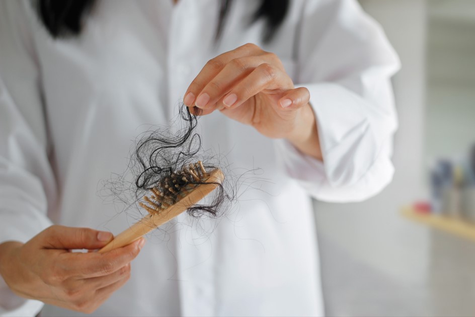 A queda de cabelo por estresse é causada pela elevação do hormônio cortisol. Ele é produzido pelo organismo para regular o metabolismo, mas há um aumento de produção quando estamos diante de uma situação estressante. Quando os níveis de cortisol estão altos, o organismo tem dificuldade em absorver substâncias, inclusive as que são responsáveis pelo crescimento capilar. Portanto, a carência de nutrientes interfere na saúde e no ciclo de vida dos fios capilares. A queda de cabelo por estresse pode ser eflúvio telógeno ou de alopécia areata, que são 2 tipos diferentes de alopécia.