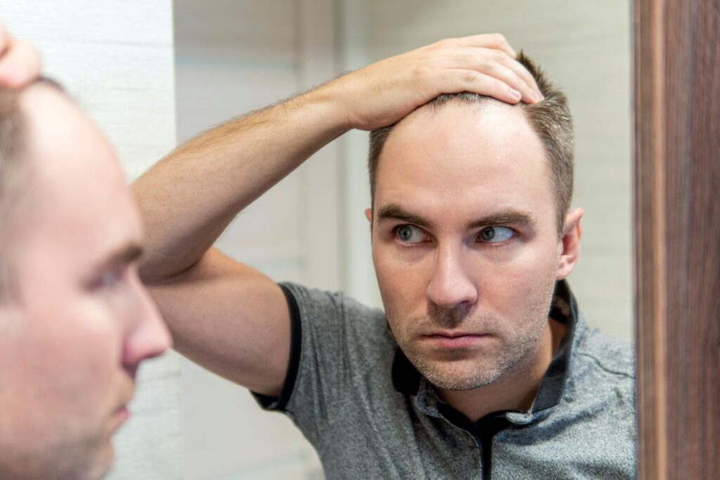Homem com entradas no cabelo se olhando no espelho.