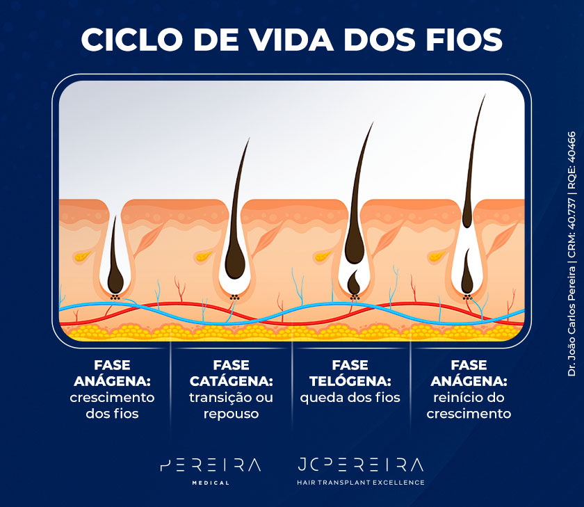 Ciclo de vida dos fios Fase anágena: crescimento dos fios Fase catágena: transição ou repouso Fase telógena: queda dos fios Fase anágena: reinício do crescimento