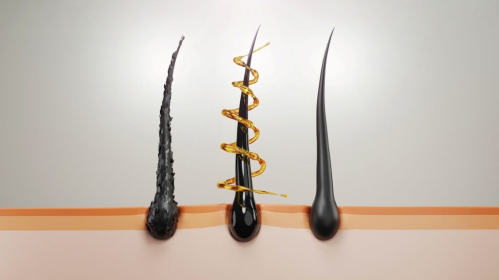 Ilustração 3D de folículos capilares.