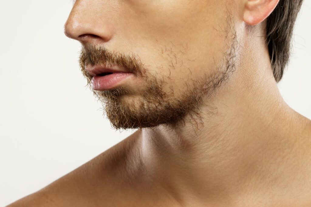 homem jovem com falhas na barba