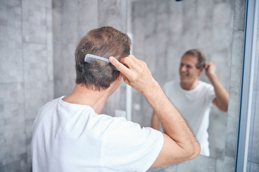 Quanto tempo dura a queda de cabelo normal? Quanto tempo dura a queda de cabelo normal