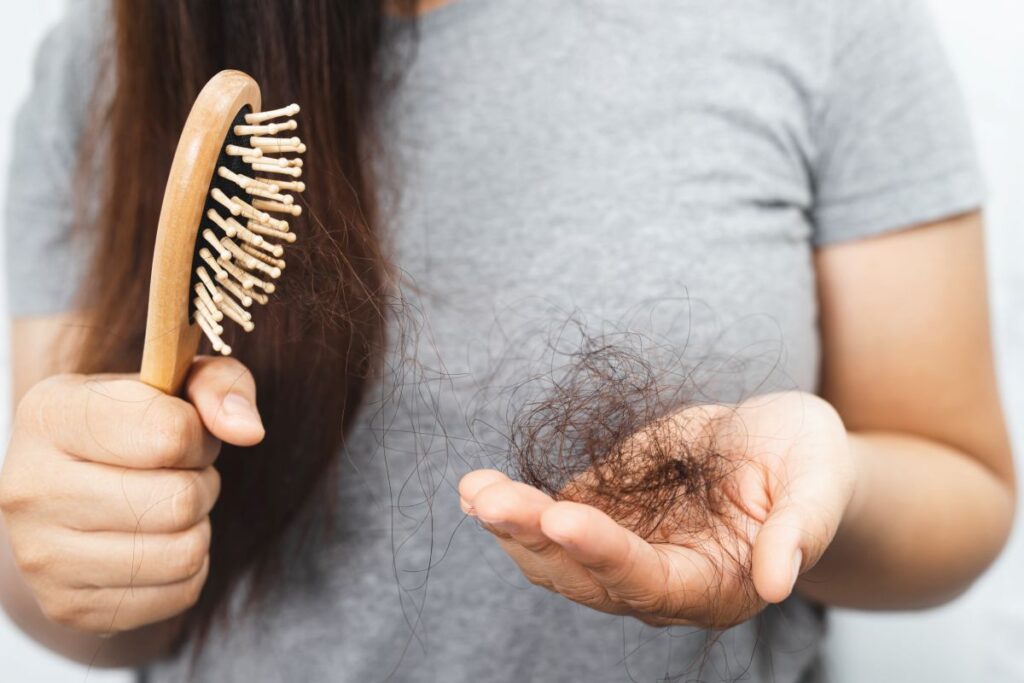 Quantos fios é normal cair por dia? Saiba o que é queda natural e quando se preocupar mulher segurando uma escova de cabelo em uma mão e, na outra, uma quantidade visível de fios de cabelo que acabaram de cair.
